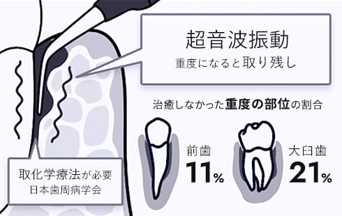 従来の治療法