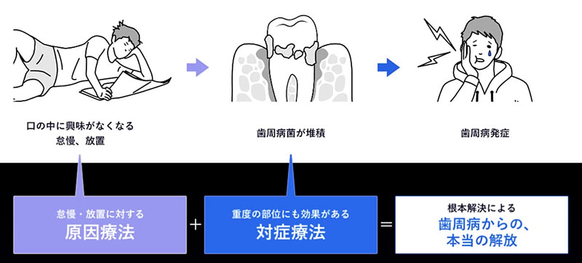 歯周病発症のメカニズム